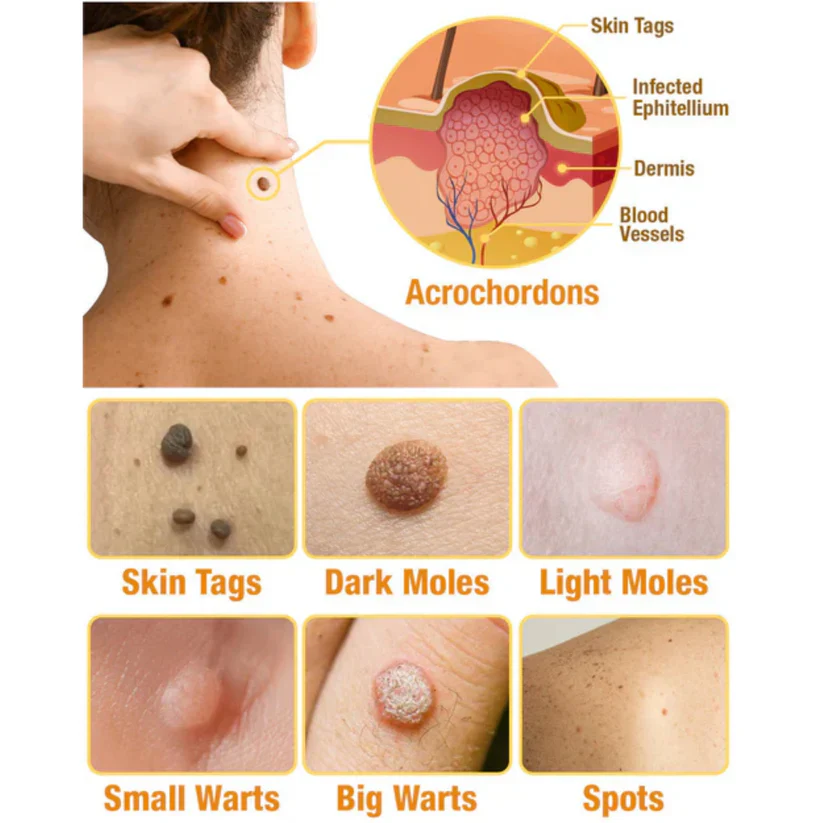 TagRecede Bee Venom Treatment Spray - Image 3