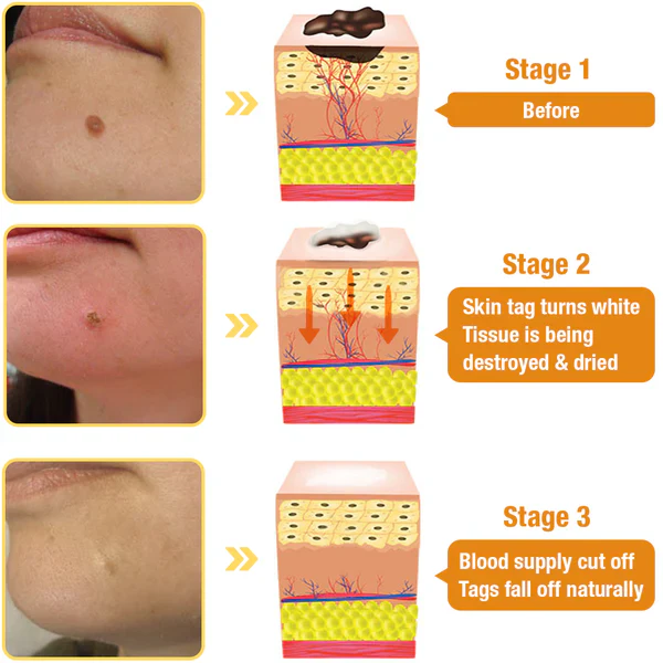TagRecede Bee Venom Treatment Spray - Image 4
