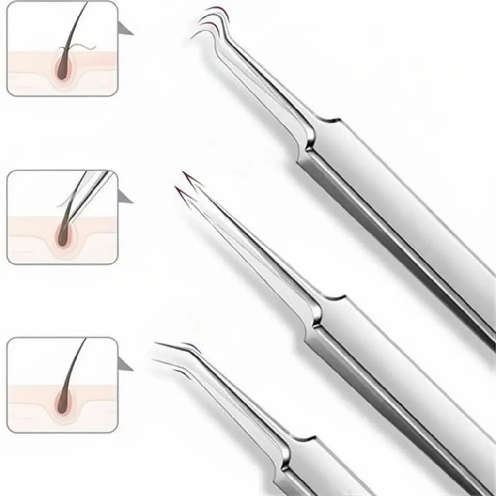 Blackhead Removal Kit - Image 3