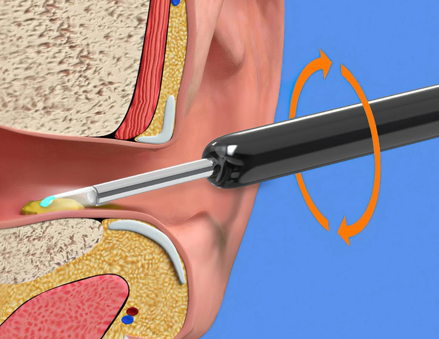 Otocam™ Ear Cleaner With Camera - Image 10