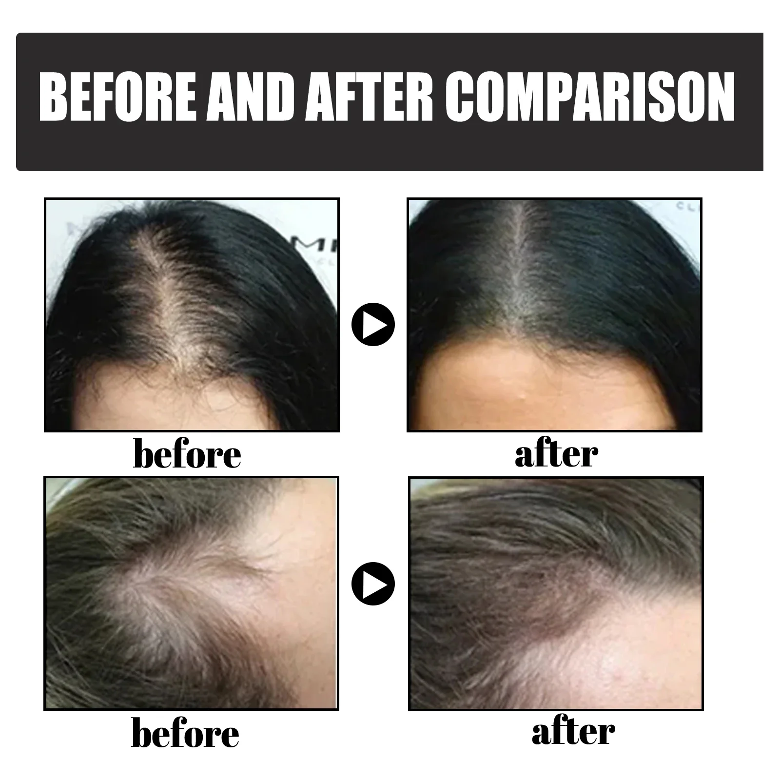 Hair Building Fibers Powder - Image 4