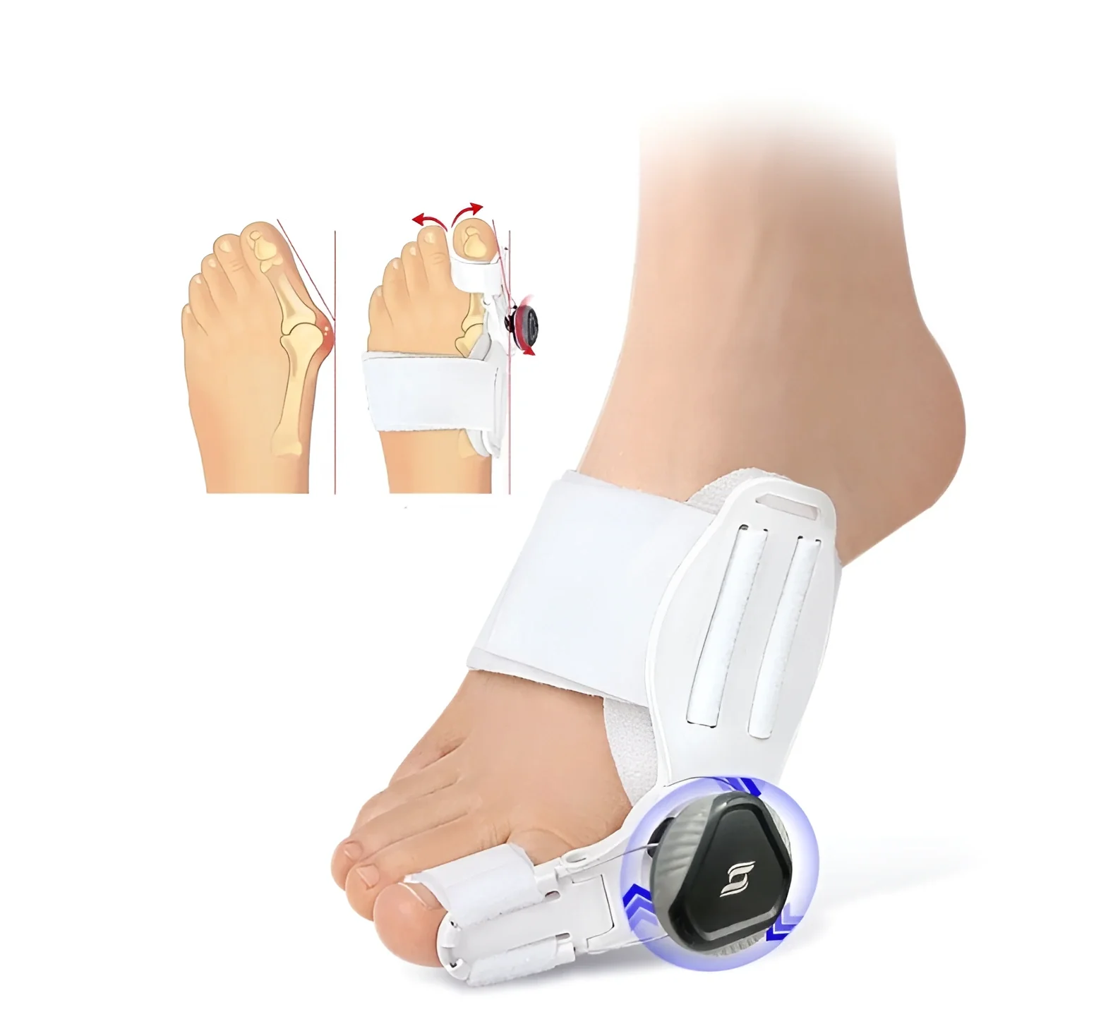 Orthopedic Toe Correction Brace - Image 4