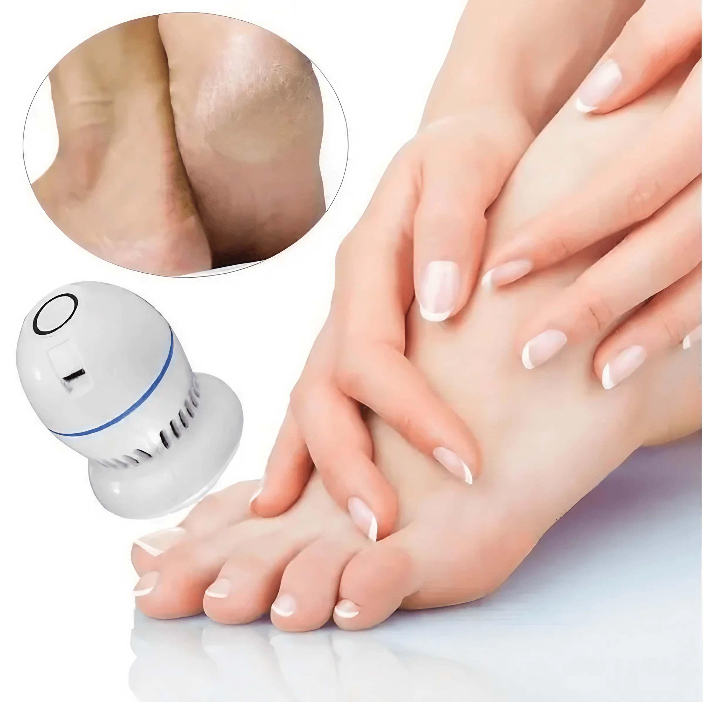 Electric Dead Skin Remover - Image 4